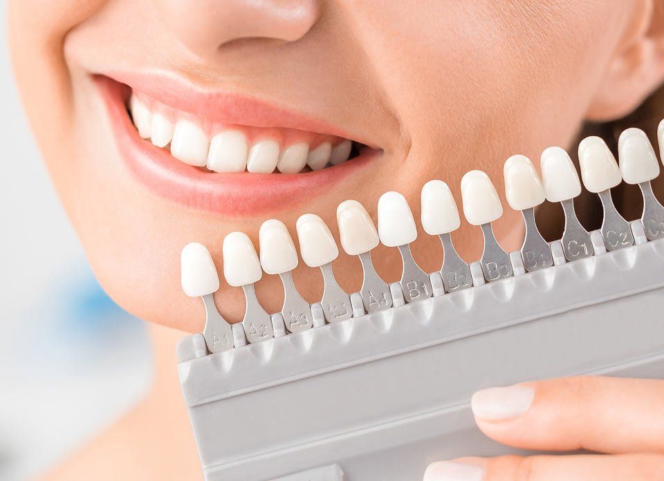 woman comparing her teeth whitening