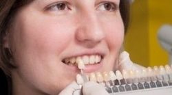 realizzazione denti, odontotecnici, protesi