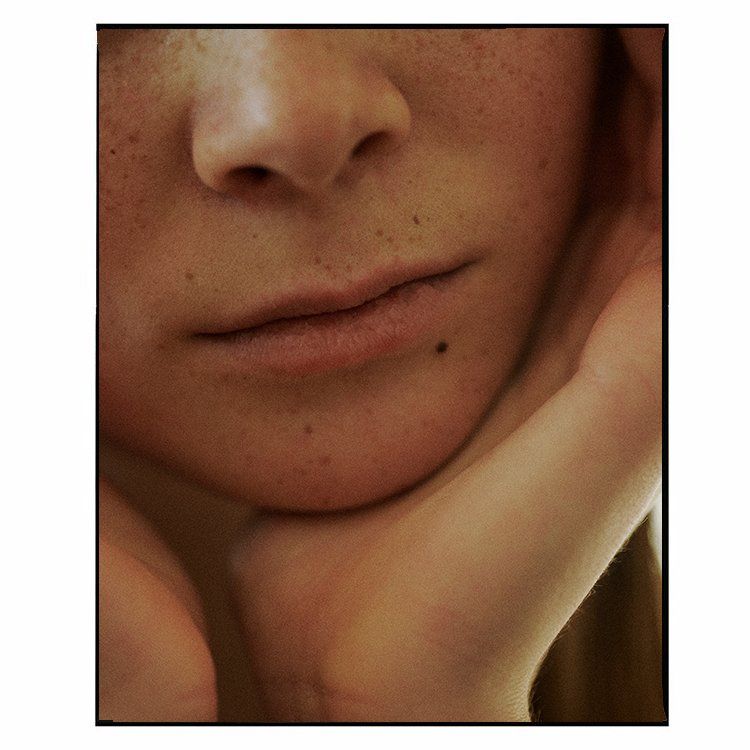 Nahaufnahme des Gesichts einer hellhäutigen Person mit Sommersprossen, das Kinn ruht auf einer Hand.