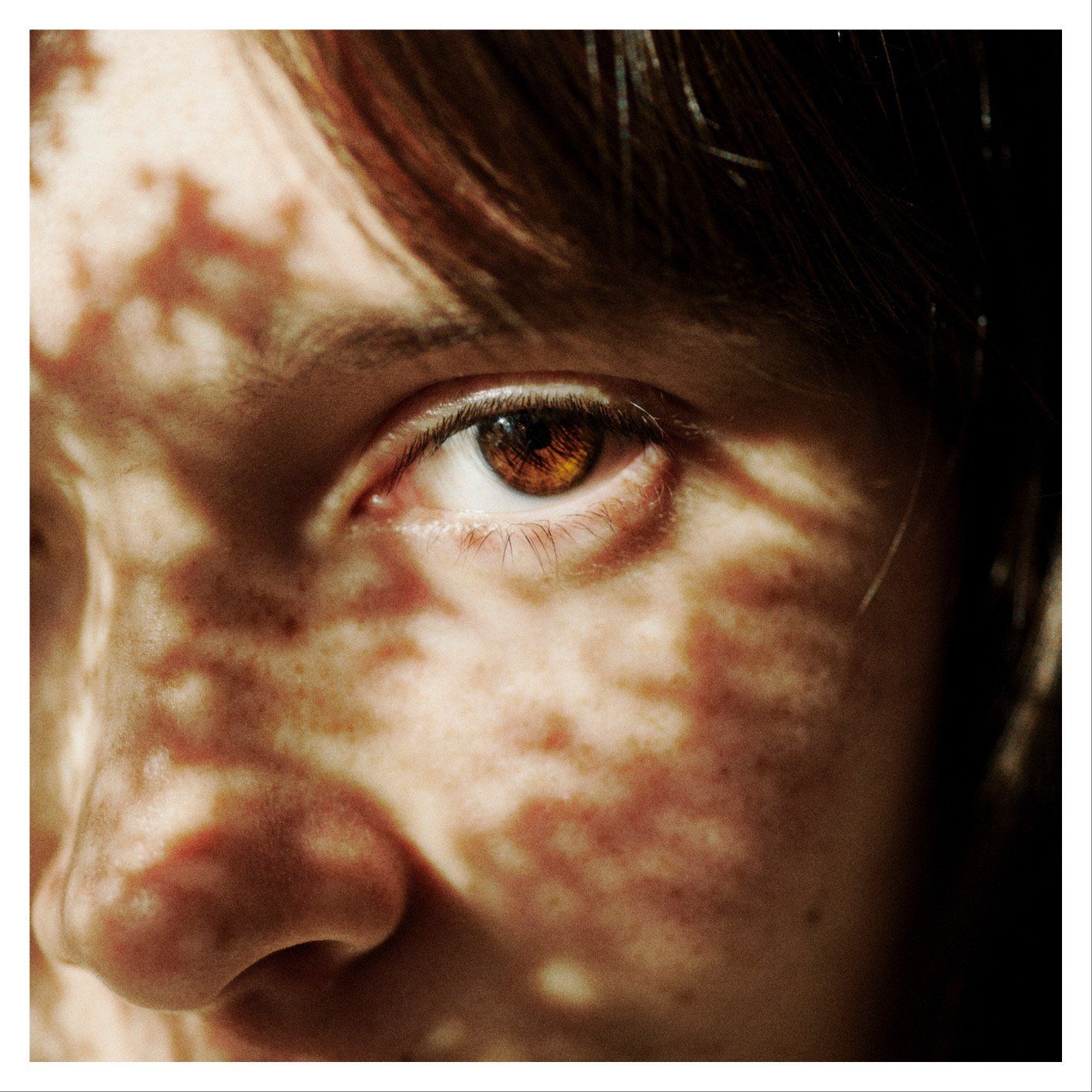 Nahaufnahme des Gesichts einer Person, braune Augen und sommersprossige Haut mit gesprenkelten Sonnenschatten.