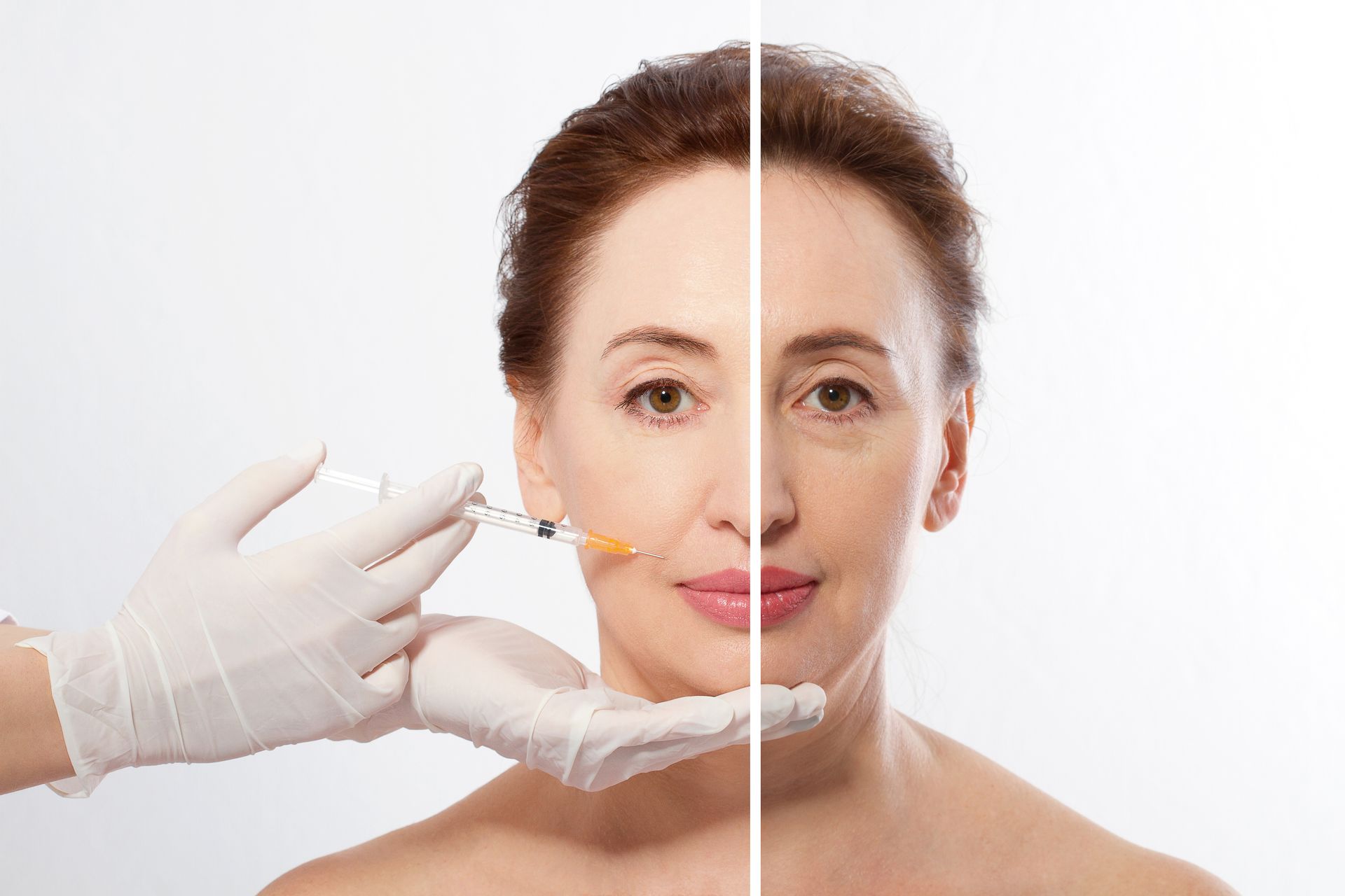 Woman receiving facial injections, before and after comparison, with white-gloved hand holding syringe.
