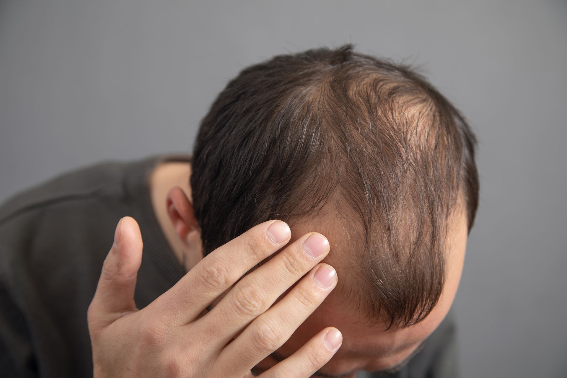 A man with a bald head is covering his face with his hand.