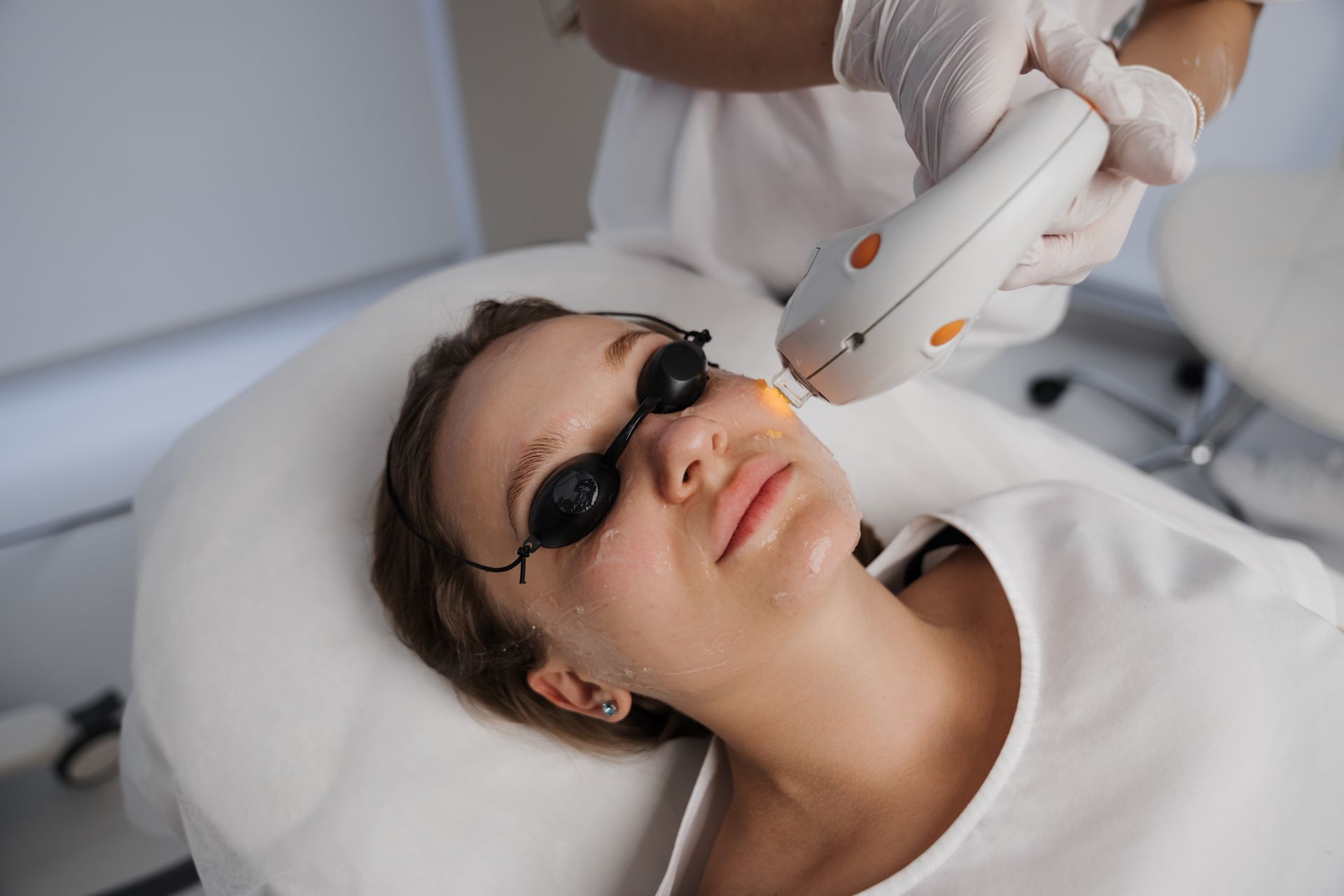 Person receiving laser facial treatment, lying down with eye protection, in a medical setting.