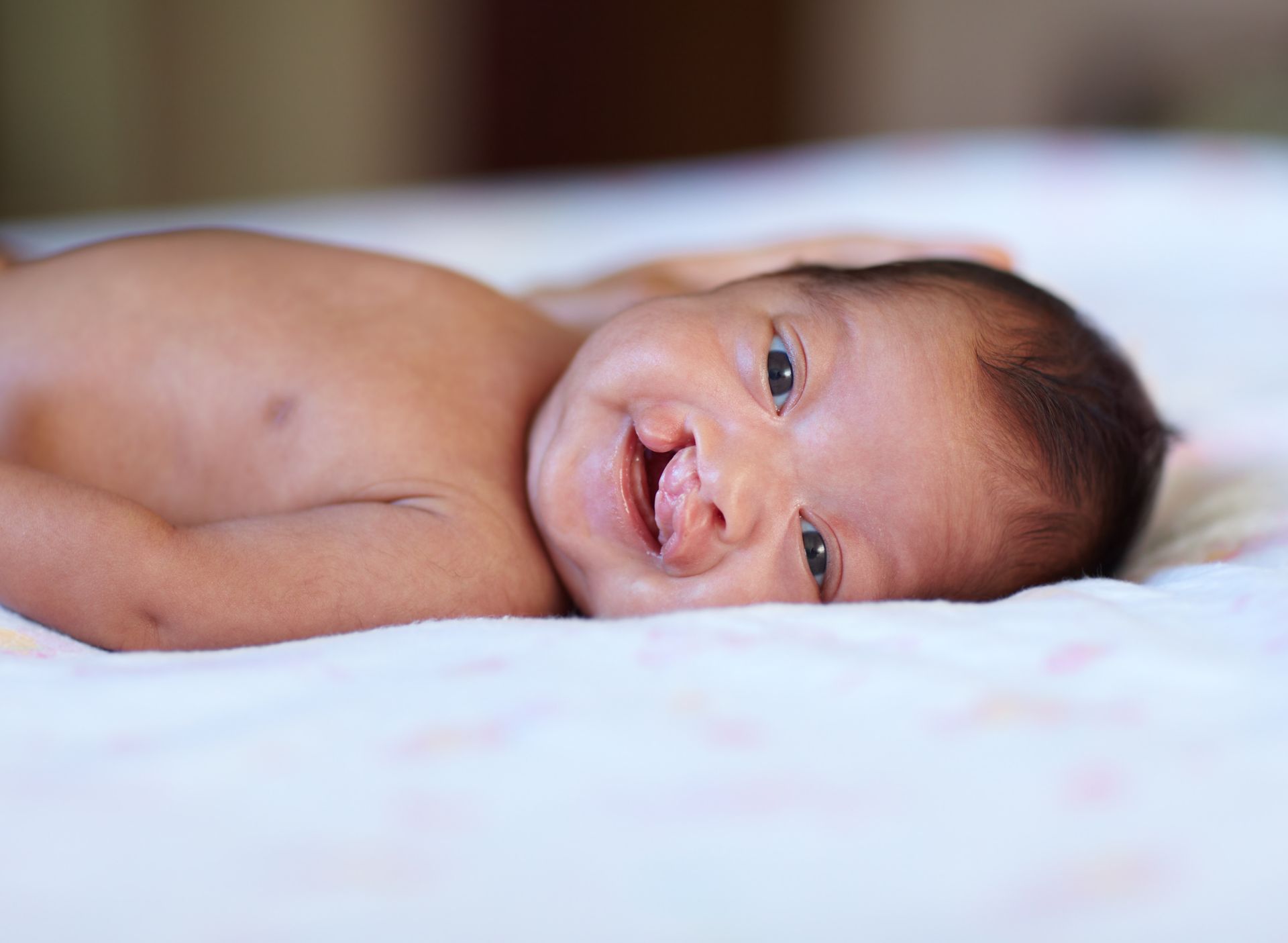 A baby with a cleft lip is laying on a bed and smiling.