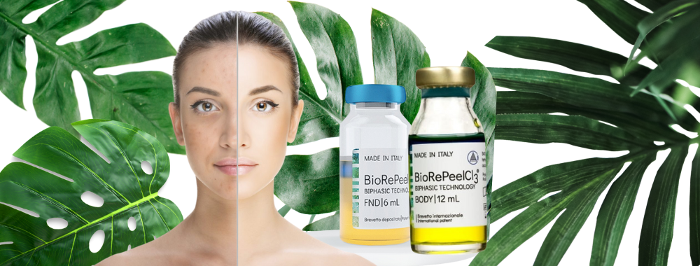 BioRePeel in Walton-on-Thames, chemical peels near me, face peels near me
