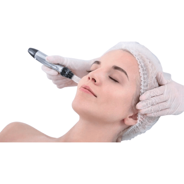 Microneedling