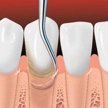 best periodontal hawaii dentists near me