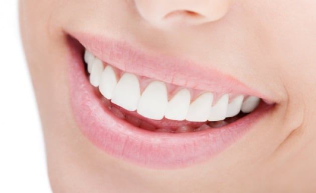Paziente dopo una pulizia attenta dei denti