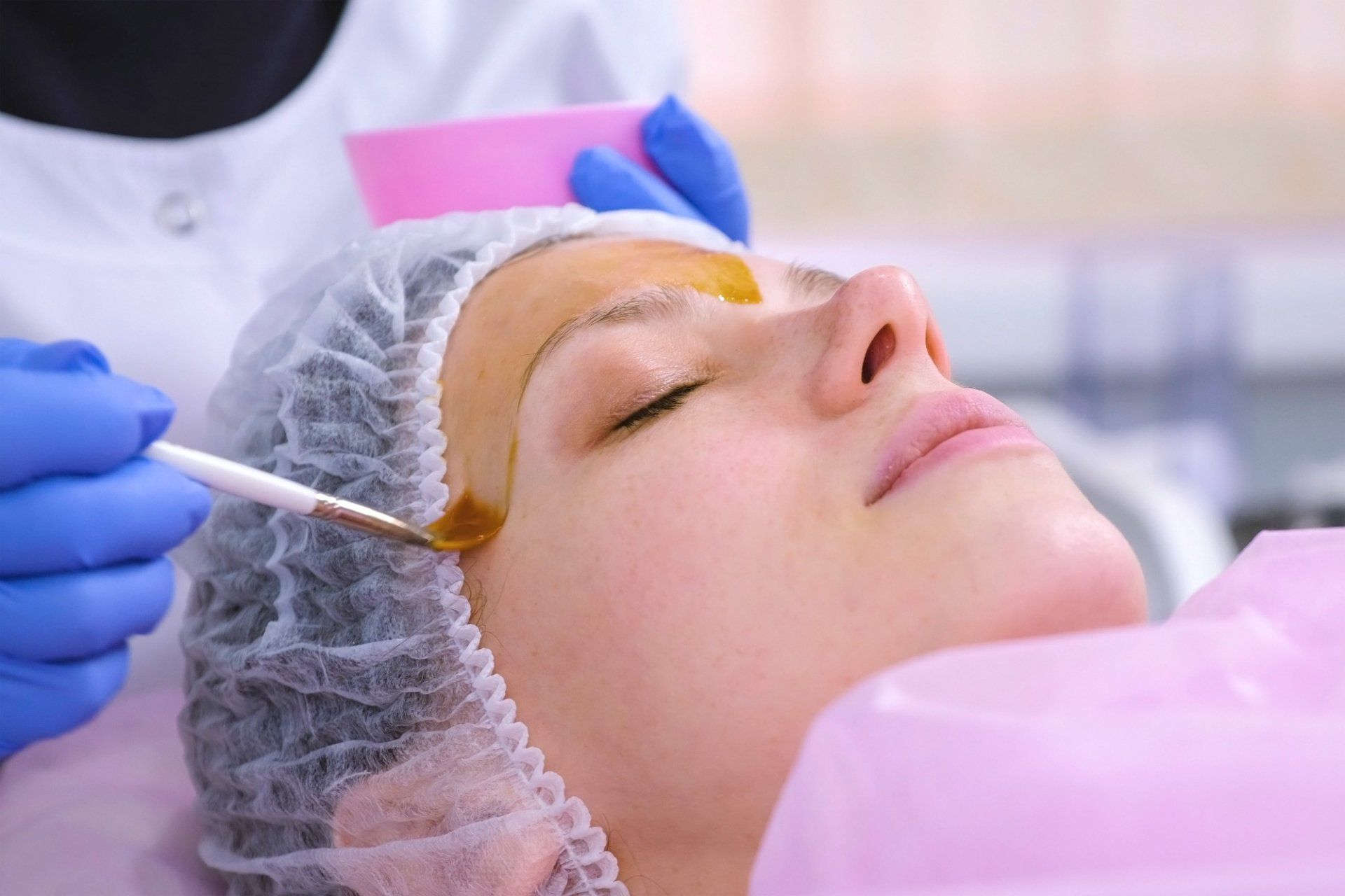 dermatologist applies chemical peel to female patient's face