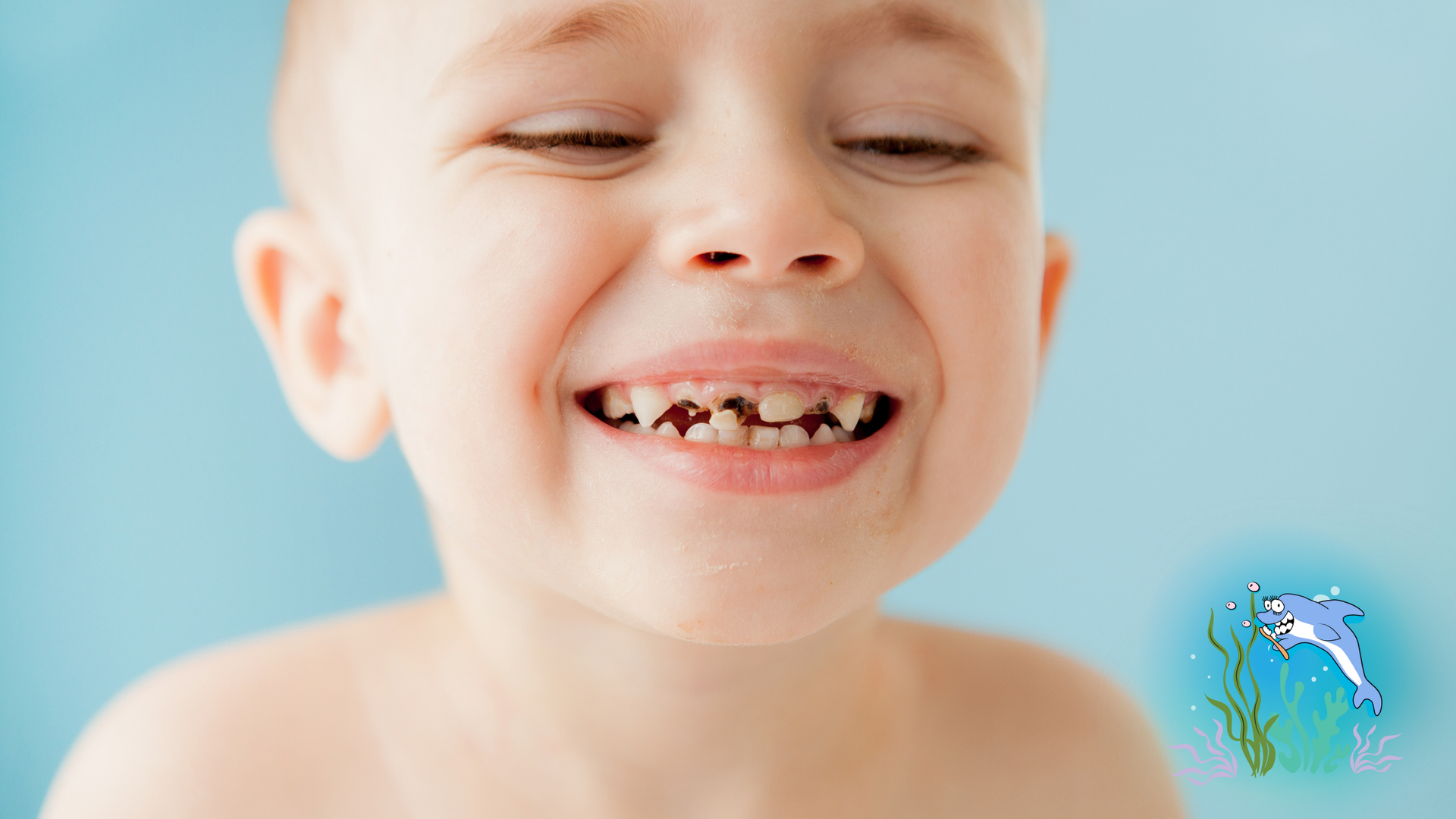 Young child with decayed teeth smiling broadly against a light blue background.