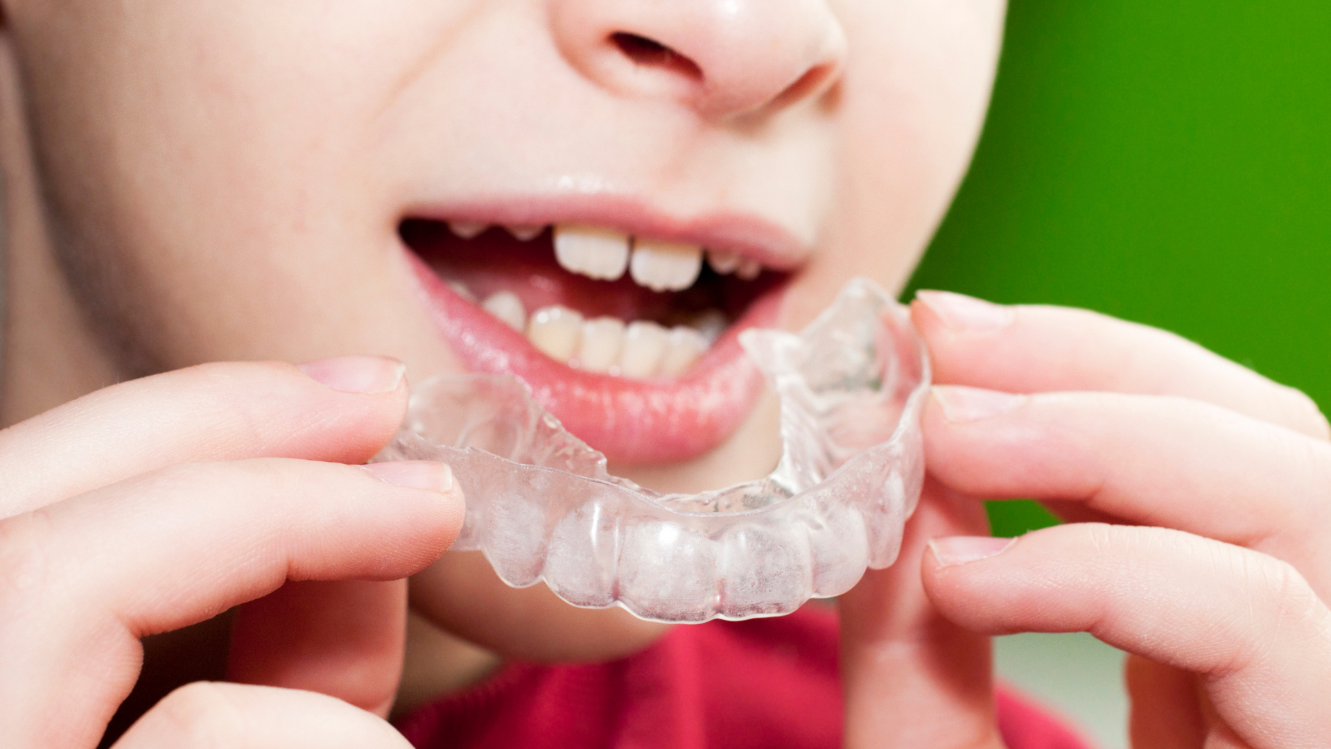 A close up of a person holding a clear brace in their mouth.