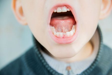 A close up of a child 's mouth with his mouth open.