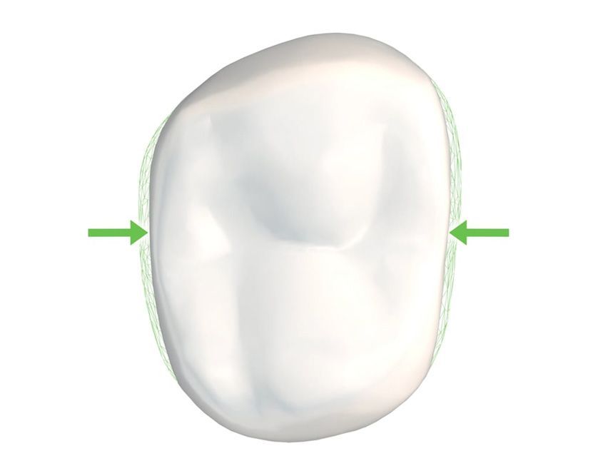 A white tooth with a green arrow pointing to it.