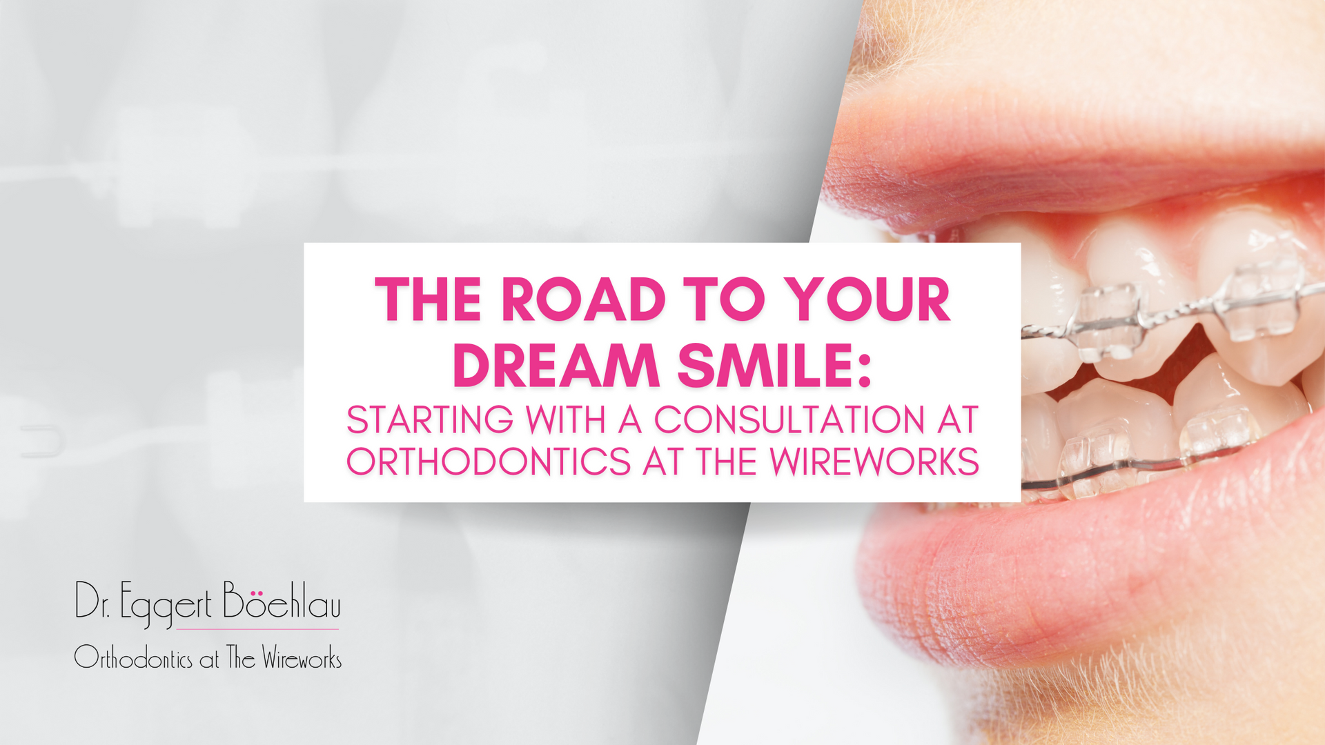 the road to your dream smile is starting with a consultation at orthodontics at the wireworks