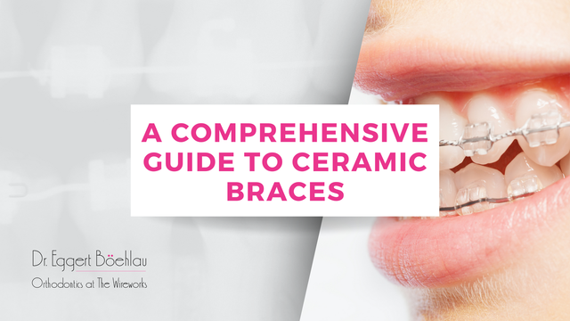A Comprehensive Guide to Ceramic Braces