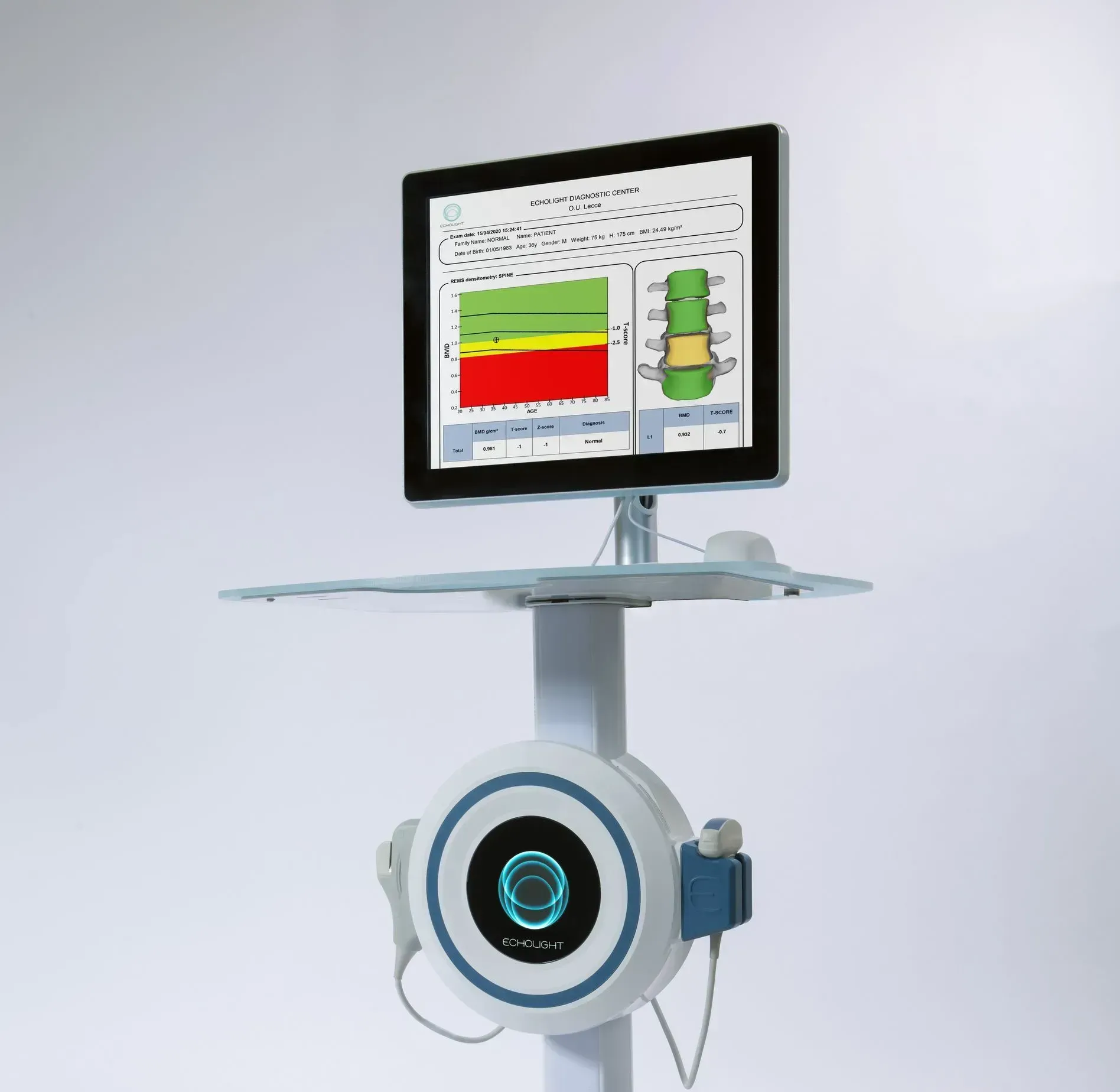 A computer monitor is sitting on top of a cart