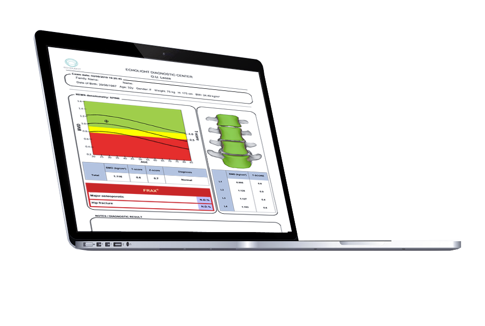 A laptop computer with a graph on the screen.