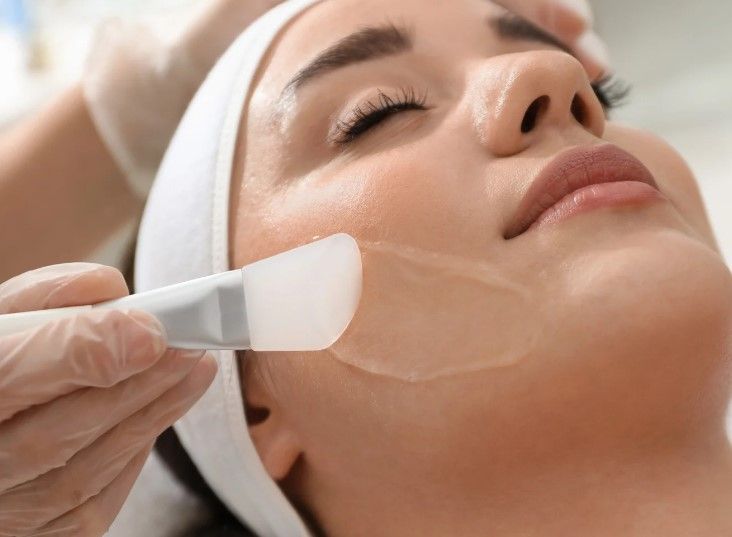 chemical peel at Cleage Clinic Bradford