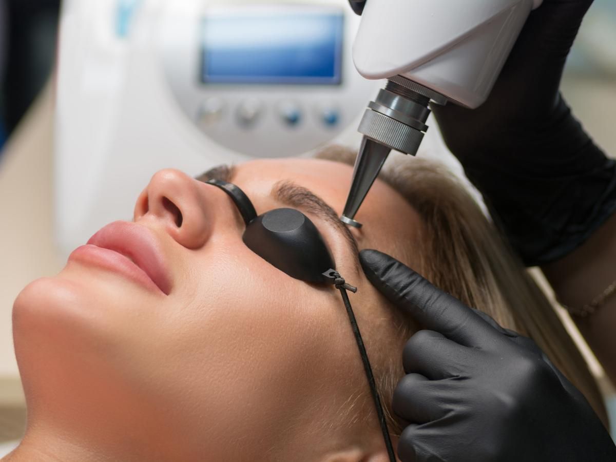 Cleage Clinic eyebrow laser tattoo removal