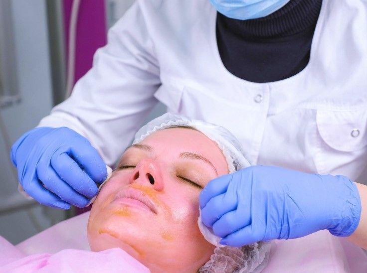 Cleage Clinic removing a skin peel