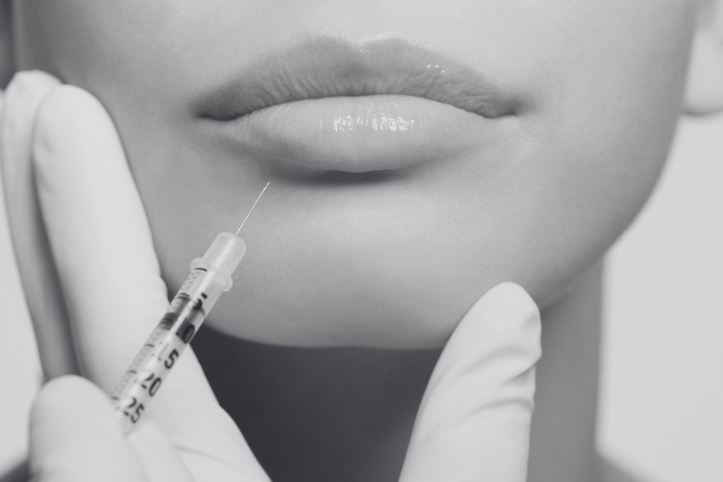 Cleage Aesthetics Clinic Leeds performing lip injections in BradfordClinic