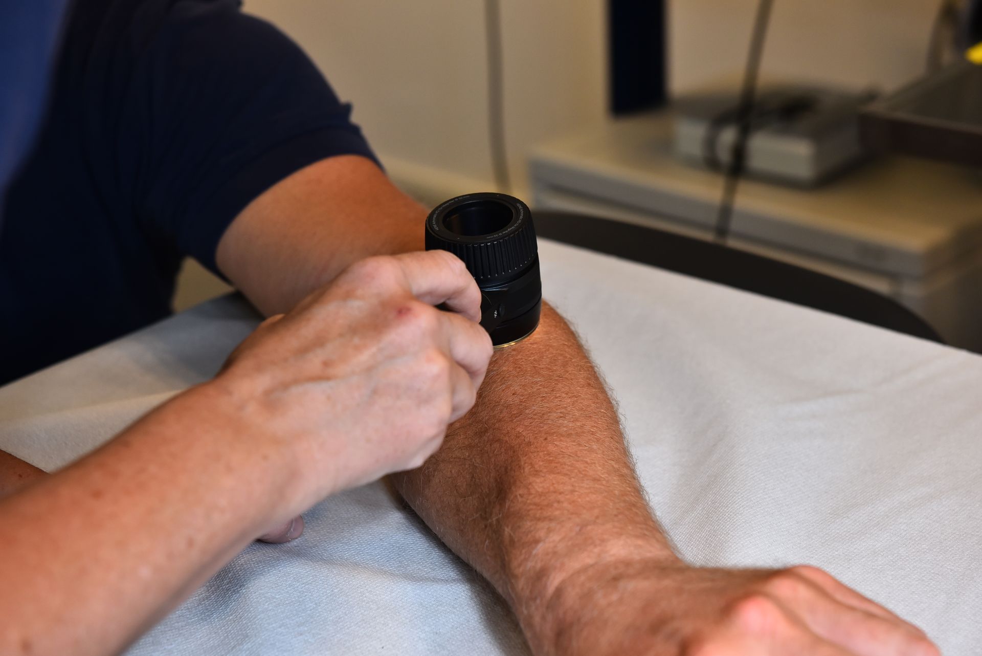 Undersøgelse af huden med dermatoskop. Dermatoskopet giver en stor forstørrelse og gør det muligt at stille en korrekt diagnose. 