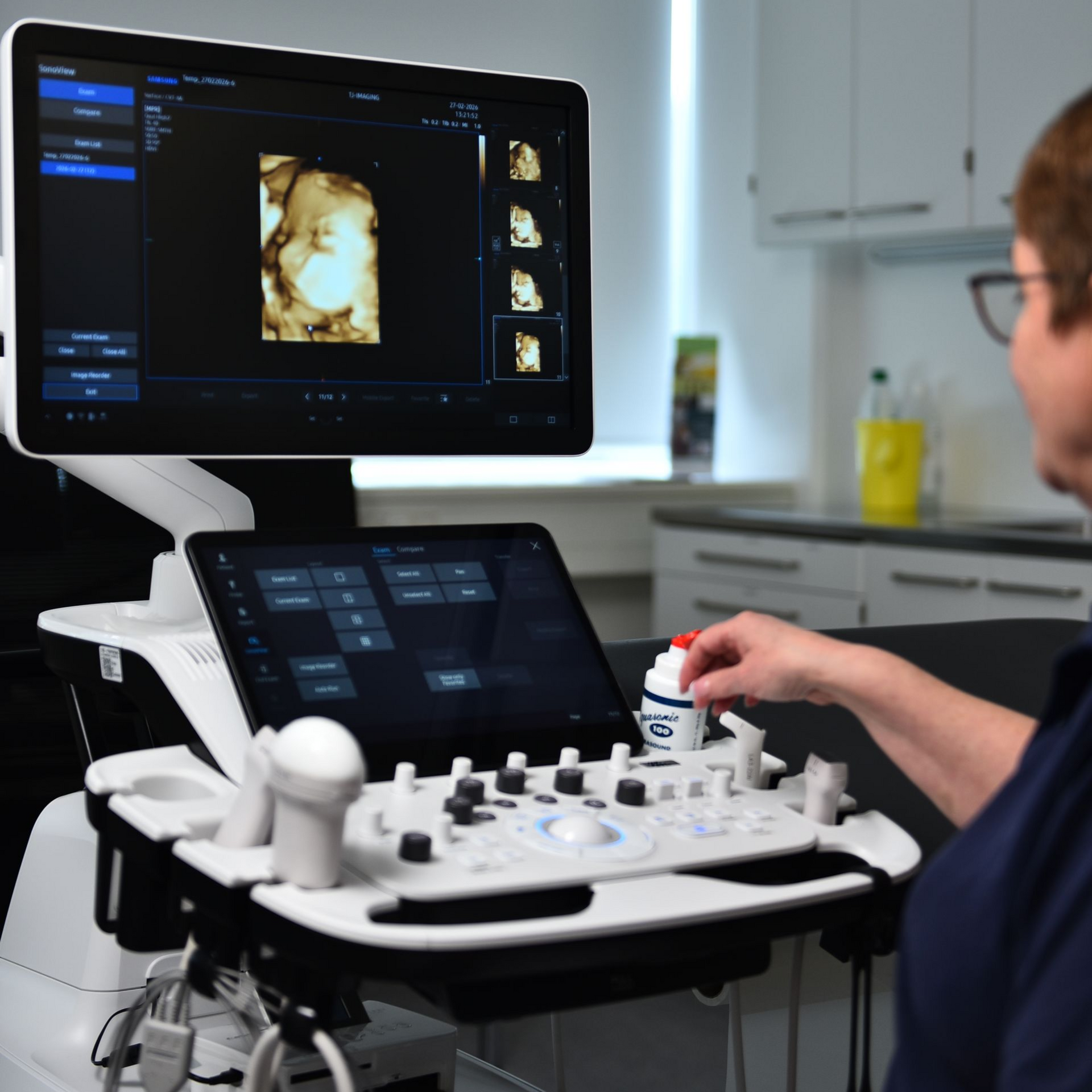 En person betjener en ultralydsmaskine, der viser et 3D-billede af et foster på en lægeklinik.