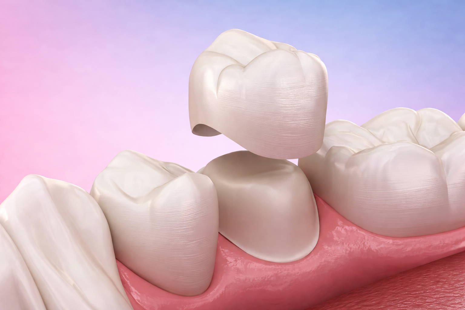 Coroa dentária em detalhe sobre o dente