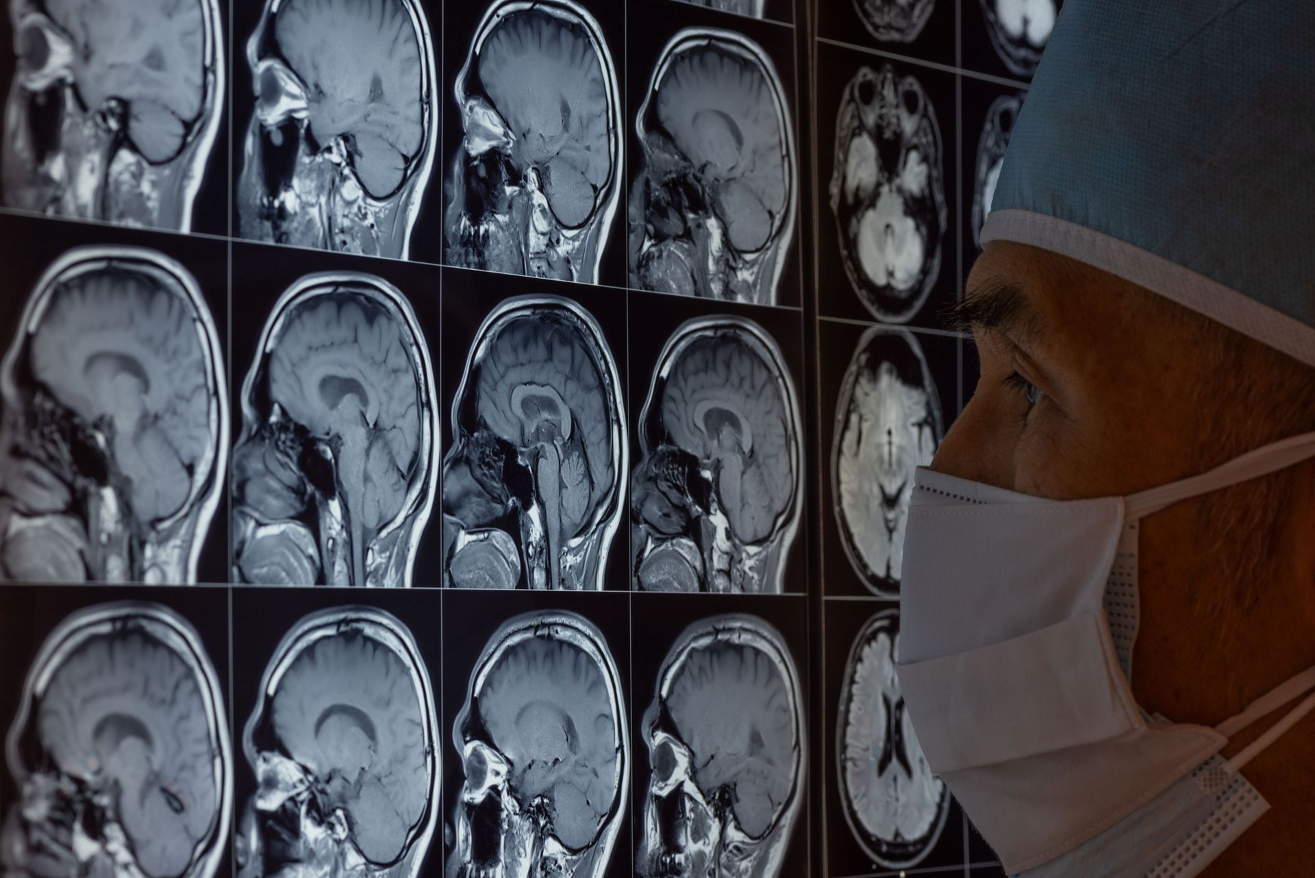 Neurosurgeon reviews brain MRI scans on a screen in a hospital while wearing a surgical mask and cap