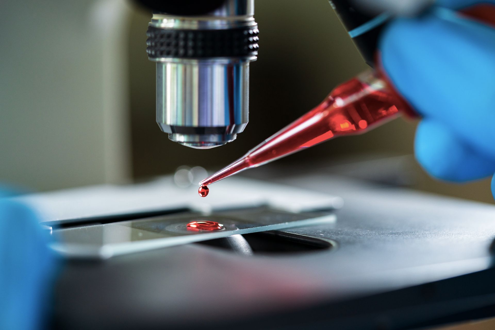 Blood Sample — Los Angeles, CA — Randox Health Labs
