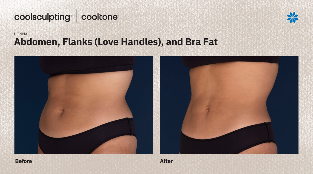 Abdomen and Love Handles