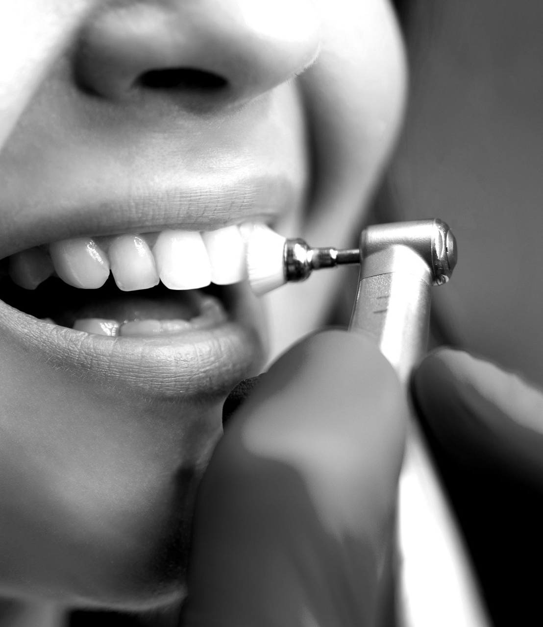 a black and white photo of a woman 's teeth being polished
