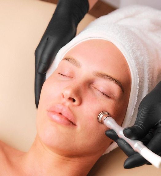 Microdermabrasion Behandlung Kosmetikstudio Hannover List