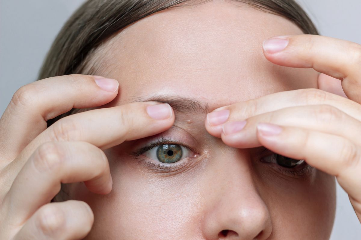 Woman gently touching skin near eyes illustrating syringoma removal treatment for smoother skin in Albuquerque.