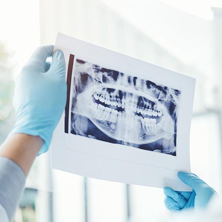 X-rays Consultations — Huntsville, AL — Inspiring Smiles Family Dentistry