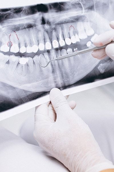Emergency Dentistry