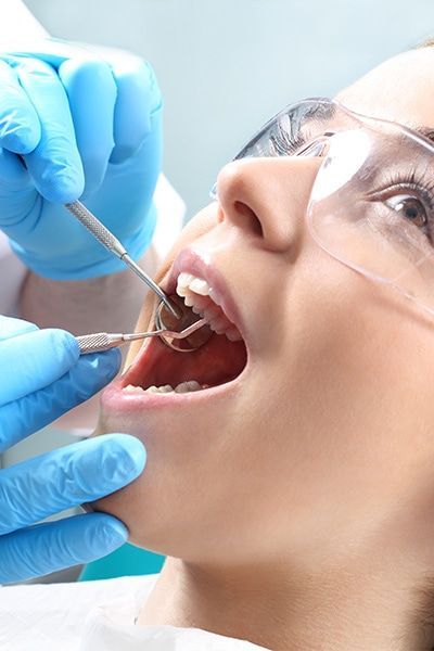 Root Canal Treatment