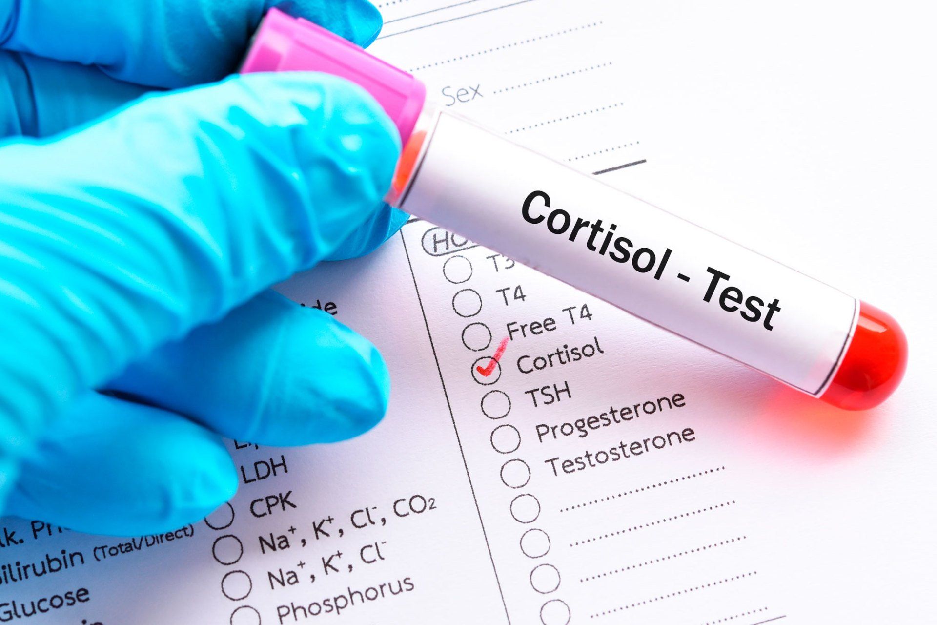 Controle do Cortisol