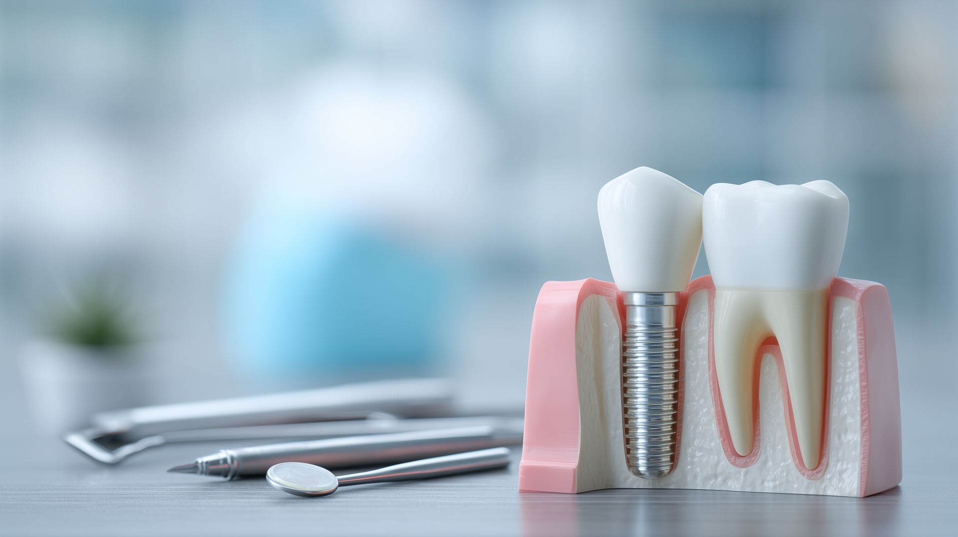Dental implant model showing titanium post and crown next to a natural tooth.