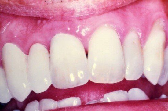 A Clean Teeth — Dentist Port Orange in South Daytona, FL
