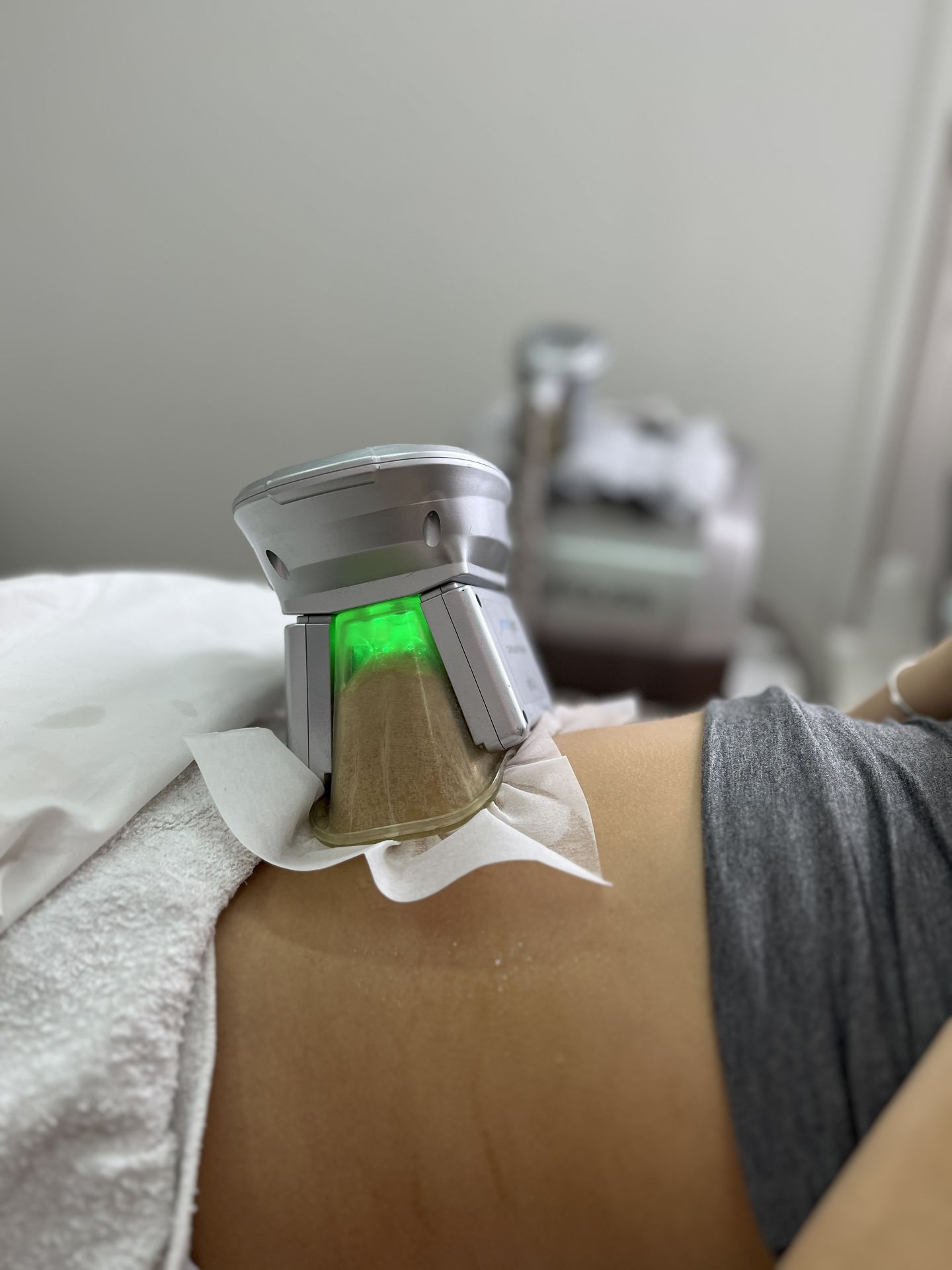 Aparatología estética