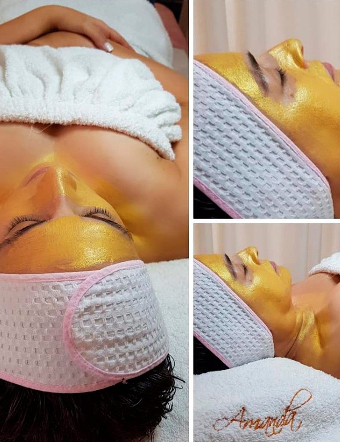 Tratamientos faciales