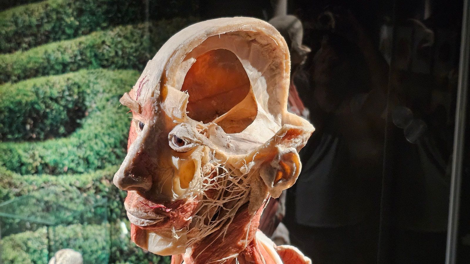 מוזיאון הגופות, אמסטרדם, הולנד