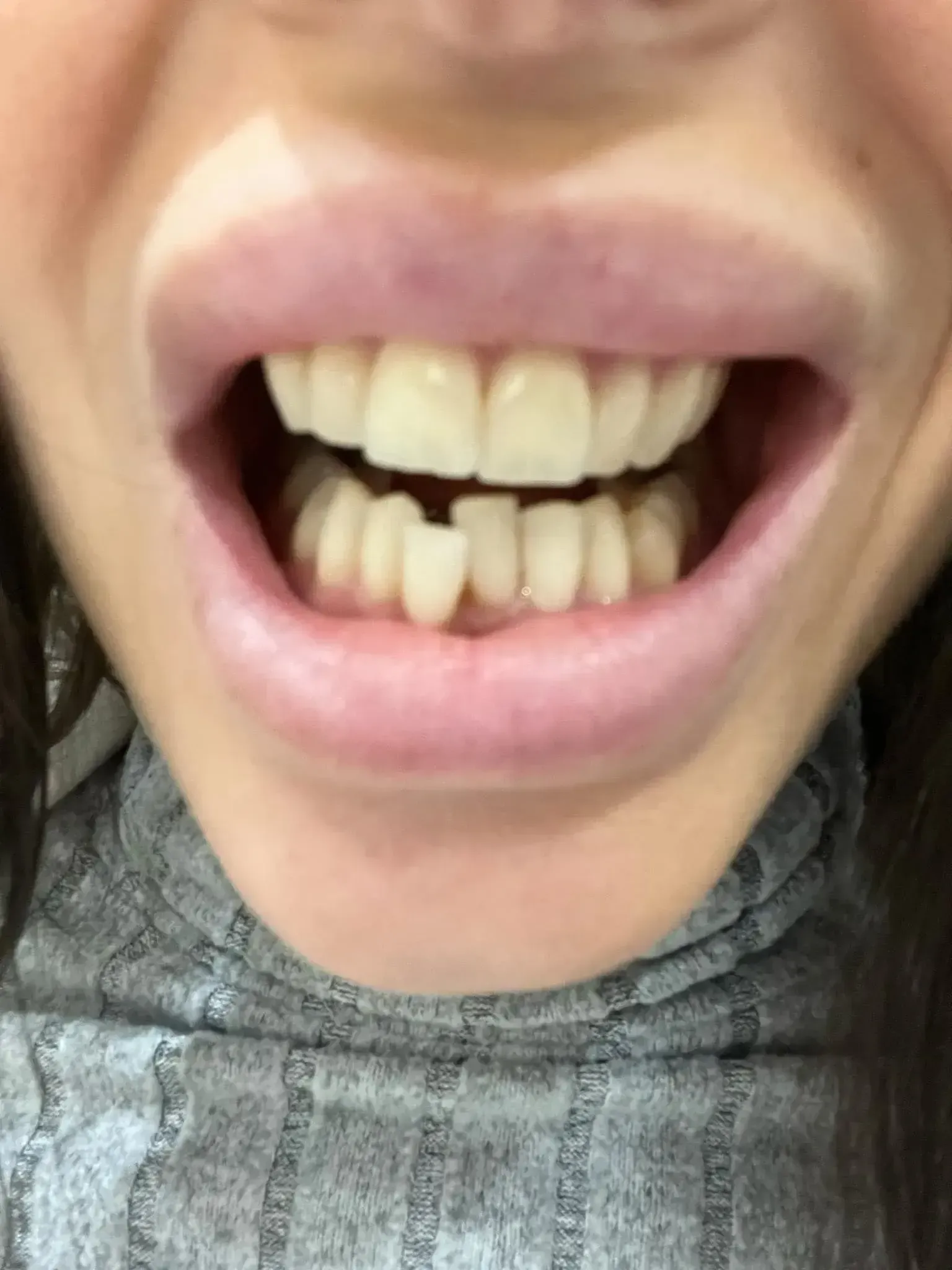 Smile before treatment