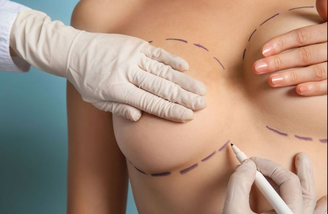 Breast surgery procedure example