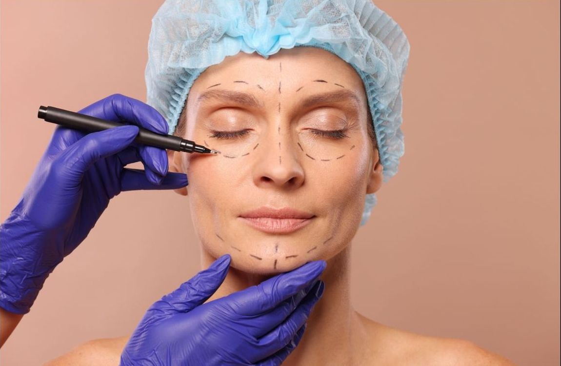 Makeover procedure example