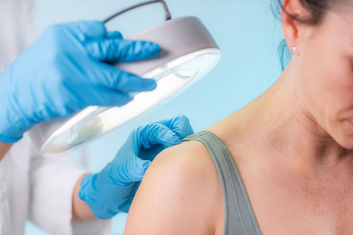 Visita dermatologica
