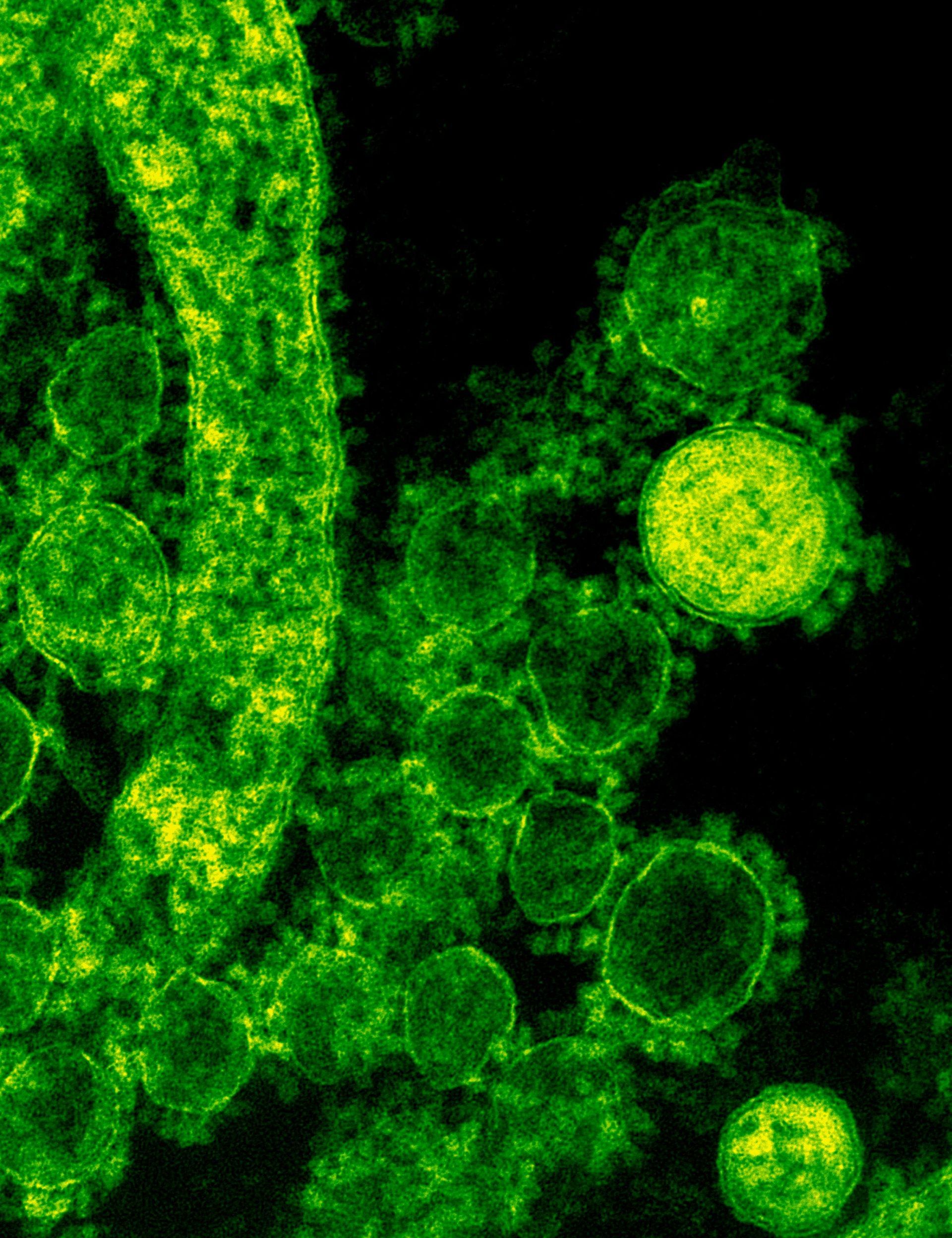 A close up of a green virus on a black background.