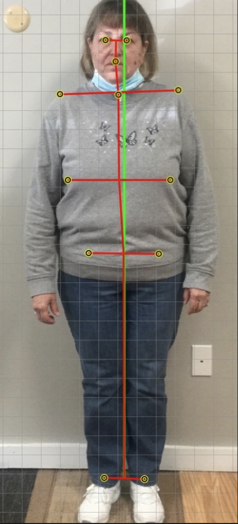 Accurate Postural Assessment, Balanced Life Chiropractic