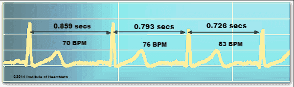 Graphic showing beat-to-beat variability in heart rate.